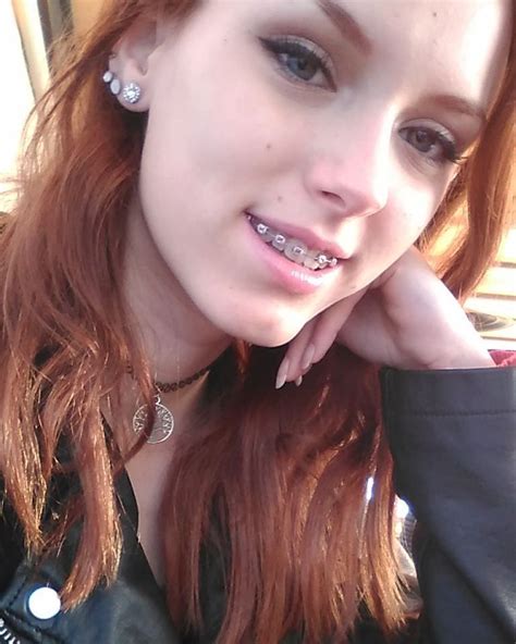 redhead with braces porn|Redhead Braces Porn Videos .